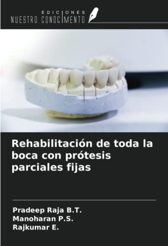 Rehabilitación de toda la boca con prótesis parciales fijas